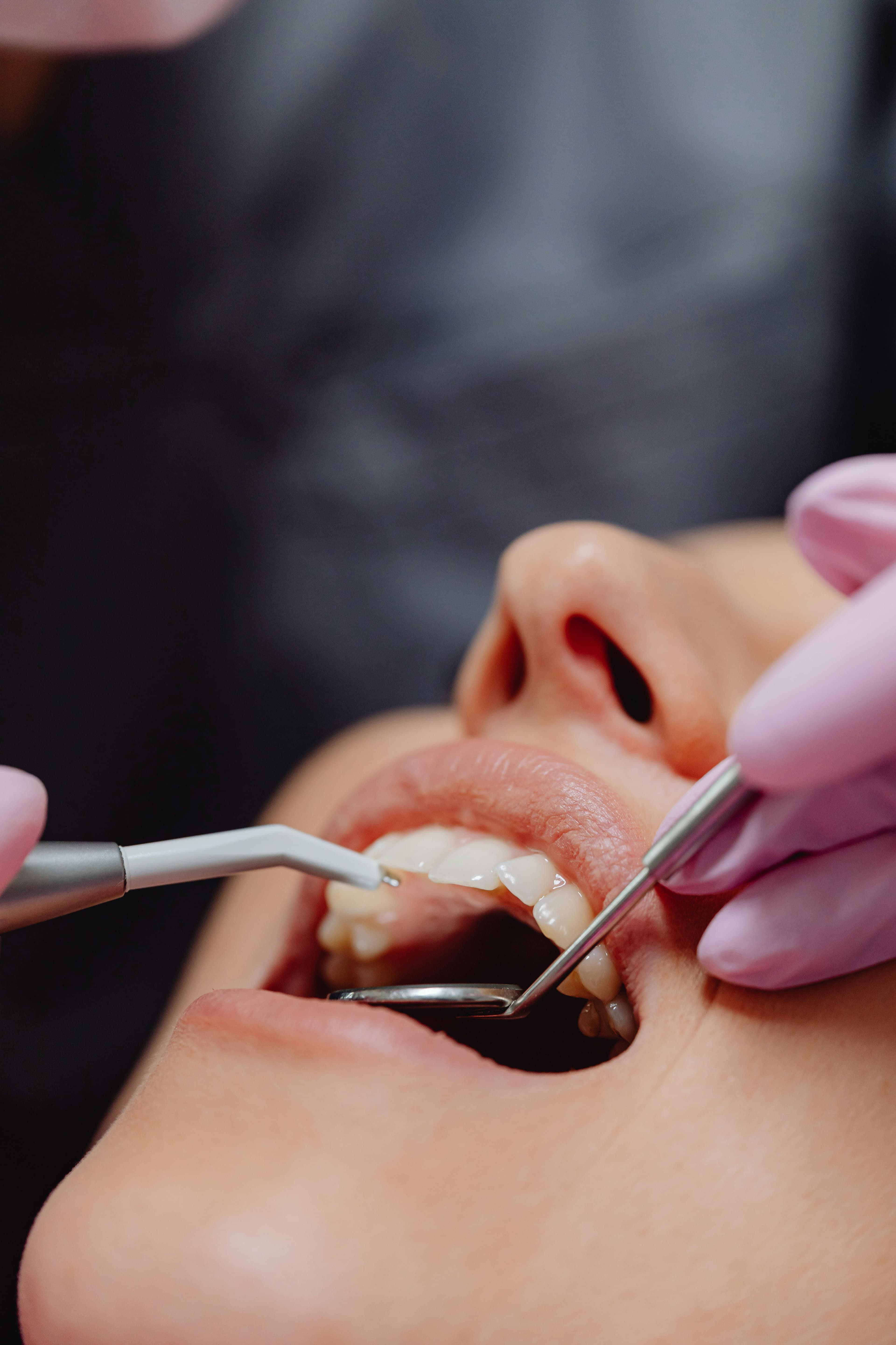 Atención dental profesional